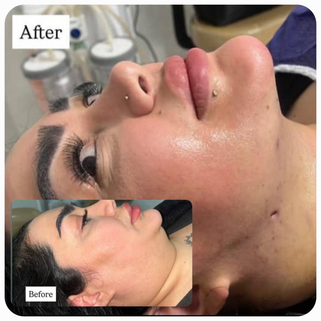 تصویر مقایسه‌ای منتشرشده در گالری جوانسازی صورت آرتان، نمونهٔ 3