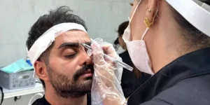 بهترین کلینیک کاشت ابرو
