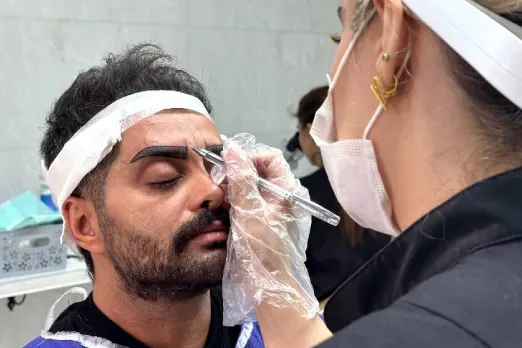کاشت ابرو آقایان