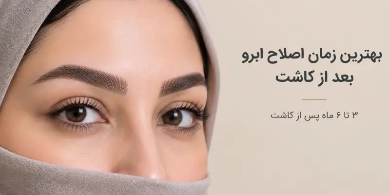 بهترین زمان اصلاح ابرو بعد از کاشت